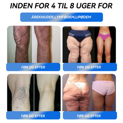 HONXI® GLP-1 Pro Vægttab Oral Opløsning👩‍⚕️En dosis om dagen – synlige resultater inden for 7 dage🔥Velegnet til kroniske sygdomme, fedme, diabetes, hjerte-kar-sygdomme🌻