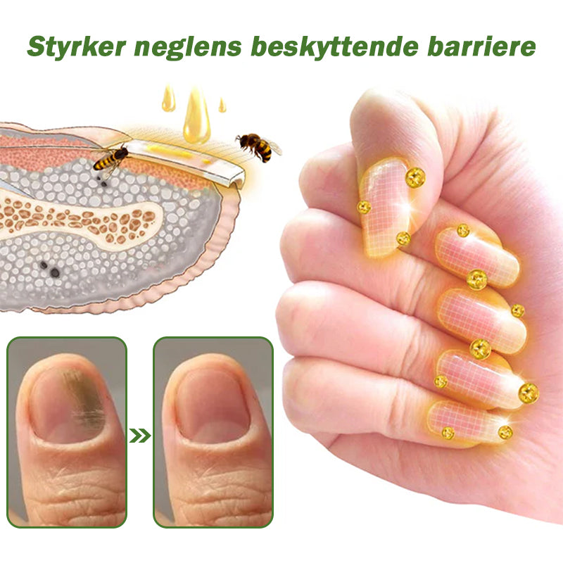 HONXI™ Neglbeskyttelse Biegift Behandlingsserum(For alle typer neglesykdommer✅For sunnere neglevekst)